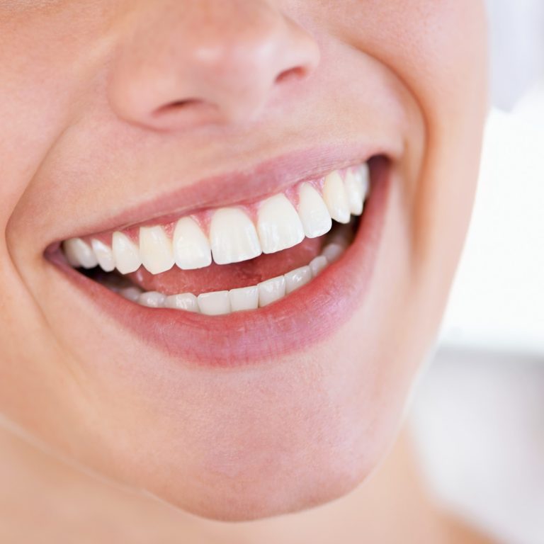 A brilliant display of pearly whites. Close up of a womans sparkling teeth