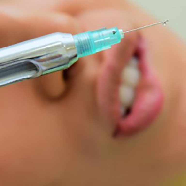 anestesia-locale-protossido-dazoto