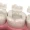 composite-inlays-and-onlays-1024x497